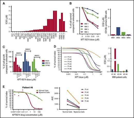 Figure 4. KPT-9274 inhibits MM cell growth and survival and overcomes promoting effect of the BM milieu. (A) A panel of 23 HMMCLs was treated with different doses of KPT-9274 for 48 hours, and cell survival was assessed by CTG. IC50 analysis was performed with GraphPad software. (B) CD138+ MM cells from 4 MM patients were cultured in the presence of different concentrations of KPT-9274 for 48 hours. Cell viability was assessed by CTG and expressed as percent change from untreated cells (left panel). IC50 analysis is also shown (right panel). (C) H929, MM1S, and OPM2 cells were cultured with and without BMSC, and in the presence of different doses of KPT-9264 for 48 hours. Cell proliferation was assessed by (3H)-thymidine uptake assay and presented as percent change from untreated cells cultured in the absence of BMSC. (D) BM from 6 myeloma patients was diluted with RPMI to seed 400 to 8000 live cells per well into 96-well plates previously prepared with increasing concentration of KPT-9274 (1 nM-10 µM) and DMSO (up to 0.5%) as vehicle and were incubated for 24 to 72 hours. After red cell lysis, cells were stained with annexin V and CD138 mAb to identify viable myeloma cells. Viable cell number was transformed to percent inhibition relative to vehicle control. Dose-response curves were fitted to nonlinear regression analysis (left panel). IC50 analysis was performed using GraphPad analysis software (right panel). (E) Left panel shows dose-response curve fitted to nonlinear regression analysis of both malignant plasma cells and normal BM cells of a representative case (patient 6). Right panel displays dose/response effect in malignant and normal BM cells of 5 myeloma patients. Data are shown as area under the curve (AUC).