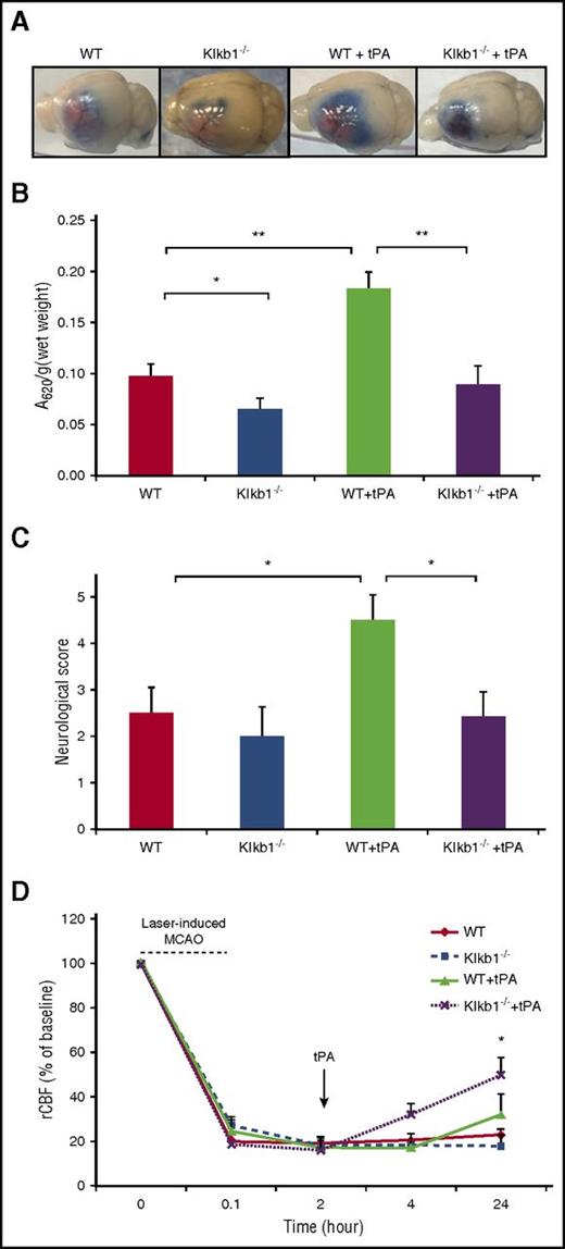 Figure 5. PPK deficiency reduced tPA-induced BBB leakage after ischemic stroke. (A) Representative images of Evans blue extravasations from WT and Klkb1−/− treated with saline or tPA (10 mg/kg) and euthanized at 24 hours after stroke. (B) Quantification of Evans blue fluorescent intensity for each group. Data are presented as mean ± SEM, n = 5-6. *P < .05; **P < .01. (C) Effects of PKal inhibition on tPA-induced neurological dysfunction after ischemic stroke. Neurological severity score was evaluated 24 hours after stroke in WT and Klkb1−/− mice treated with saline or tPA (10 mg/kg). Data are presented as mean ± SEM, n = 5-7. *P < .05. (D) PKal inhibition accelerates reperfusion during tPA treatment after stroke. Quantitative analysis of rCBF showed facilitated reperfusion in Klkb1−/− mice. Laser-Doppler flowmeter was used to monitor rCBF for up to 2 hours and at 24 hours after tPA treatment. Data are presented as mean ± SEM, n = 3-6. *P < .05 vs WT + tPA.