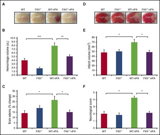 Figure 6. FXII deficiency reduces infarct volume and edema after tPA treatment in thrombotic stroke without increasing the risk of intracerebral hemorrhage. (A) Representative images of coronal sections of show cerebral hemorrhage 24 hours after stroke in mice treated with vehicle or tPA in WT and FXII−/− mice. At 2 hours after stroke onset, mice received tPA (10 mg/kg) or saline vehicle. (B) Volumes of intracerebral hemorrhage were quantified with hemoglobin assay at 24 hours after stroke. Data are presented as mean ± SEM, n = 8. **P < .01; ***P < .001. (C) Quantitative analysis of brain edema at 24 hours after ischemic stroke. Data are presented as mean ± SEM, n = 8. *P < .05. (D) Representative coronal sections of 2,3,5-triphenyltetrazolium chloride–stained brain sections of mice at 24 hours after ischemic stroke treated with vehicle or tPA in WT and FXII−/− mice. (E) Quantitative analysis of infarct volume at 24 hours after ischemic stroke. Data are presented as mean ± SEM, n = 8. *P < .05. (F) Effects of FXII inhibition on tPA-induced neurological dysfunction after ischemic stroke. Neurological severity score was evaluated 24 hours after stroke in WT and FXII−/− mice treated with saline or tPA (10 mg/kg). Data are presented as mean ± SEM, n = 5-8. *P < .05.