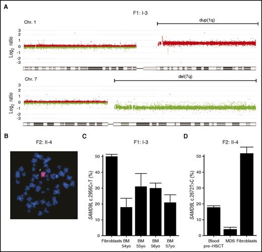 Figure 3. Loss of the SAMD9L gain-of-function–mutated allele in myelodysplastic cells. (A) Microarray-based comparative genomic hybridization of bone marrow–derived DNA of F1:I-3 showing duplication of 1q (in red) and deletion of 7q (in green), consistent with the der(1;7)(q10;p10) finding by karyotype. (B) Fluorescence in situ hybridization analysis with chromosome 7 painting reveals monosomy 7 in bone marrow cells from F2:II-4. (C) Frequency of SAMD9L c.2956C>T mutation relative to wild type assessed by mutation-specific droplet-dPCR in fibroblasts and serial bone marrow samples of F1:I-3. (D) Frequency of SAMD9L c.2672T>C mutation relative to wild type assessed by mutation-specific dPCR in DNA derived from MDS, peripheral blood, and fibroblasts of F2:II-4. For each sample, the data displayed is the combination of at least 2 dPCR chips. Error bars show 95% confidence levels.