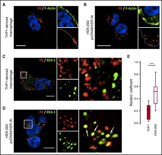 Figure 1. FX is internalized by SR-AI in HEK293 cells but not in THP1-derived macrophages. THP1-derived macrophages (A,C) or SR-AI–expressing HEK-293 (B,D) were incubated with FX for 1 hour at 37°C. FX was immunostained (red) along with polymerized actin counterstaining using Alexa488-labeled phalloïdin (A-B) or EEA-1 immunostaining (C-D). Dotted lines define cell boundaries based on phalloïdin staining (A-B), and arrows indicate spots of colocalization (C-D). Images were acquired in confocal microscopy (objective 63×, z-depth 1 µm). Bars represent 10 µm. (E) FX colocalization with EEA-1 was quantified by calculating the tMC for FX using JACoP plugin in Fiji software. The results are expressed in a whisker plot where boxes represent the median and 25th to 75th percentile and bars represent the minimum and maximum of 10 to 11 cells in 3 different experiments. ***P < .001 in a Mann-Whitney nonparametric unpaired statistical test.