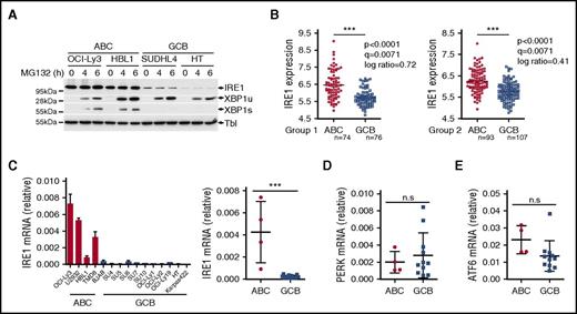 Figure 2. IRE1 mRNA levels are downregulated in GCB DLBCL. (A) Two ABC and 2 GCB DLBCL cell lines were treated for 4 or 6 hours with 10 μM proteasome inhibitor MG132. IRE1, XBP1u, and XBP1s protein expression was analyzed by immunoblot. Tubulin (Tbl) is used as loading control. (B) IRE1 mRNA levels in GCB-DLBCL (GCB) compared with ABC-DLBCL (ABC) molecular subtype in 2 independent gene expression–profiled DLBCL data sets GSE10846. Genes were considered differentially expressed between ABC and GCB if bearing a P < .005, q < 0.05, and an absolute log ratio > 0.3 in both cohorts. (C-E) Representative ABC and GCB DLBCL cell lines were analyzed for mRNA expression levels of IRE1 (C), PERK (D), and ATF6 (E) relative to β-actin. Relative IRE1 expression (mean and SD of technical triplicates of 1 representative experiment) for each cell line tested is shown in panel C (left panel). Statistical analyses were done using the unpaired Student t test to compare relative mRNA expression between ABC and GCB cells. ***P ≤ .001 (n.s.); P > .05. n.s., not significant.