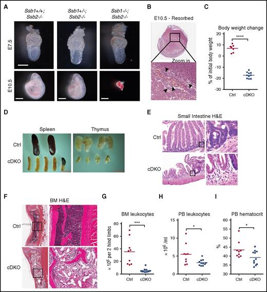 Figure 1. Early embryonic lethality in constitutive Ssb1/Ssb2 double knockout (DKO) mice and acute mortality in conditional Ssb1/Ssb2 double knockout (cDKO) mice due to BM failure and small intestine atrophy. (A) Embryos at E7.5 (upper panel; scale bar = 200 μm) and E10.5 (lower panel, scale bar = 1 mm) from Ssb1+/−;Ssb2−/− intercrossed, timed matings. (B) Histologic analyses of resorbed embryos from E10.5. Apoptotic bodies are indicated by black arrows. Images were acquired at ×1 (top) and ×40 (bottom) magnification. (C) Body weight change on day 7 of TAM-induced adult Ctrl and cDKO mice. (D) Representative images of spleen and thymus recovered from Ctrl and cDKO mice on day 7 postinduction with TAM (1 mg/day by IP injection for 5 consecutive days). (E) H&E staining of small intestine sections. Images were acquired on day 7 postinduction at ×20 (left) magnification and zoomed in ×16 for indicated areas (right). (F) H&E staining of BM sections. Images were acquired on day 7 postinduction at ×4 (left) and ×20 (right) magnifications. (G) BM cell count. (H-I) Leukocyte and hematocrit counts in peripheral blood (PB) from Ctrl and cDKO mice on day 7 postinduction with TAM (1 mg/day by IP injection for 5 consecutive days). Statistical analysis represents t test. Each point represents an individual mouse/biological replicate. See also supplemental Figure 1. *P < .05; **P < .01; ***P < .001; ****P < .0001.
