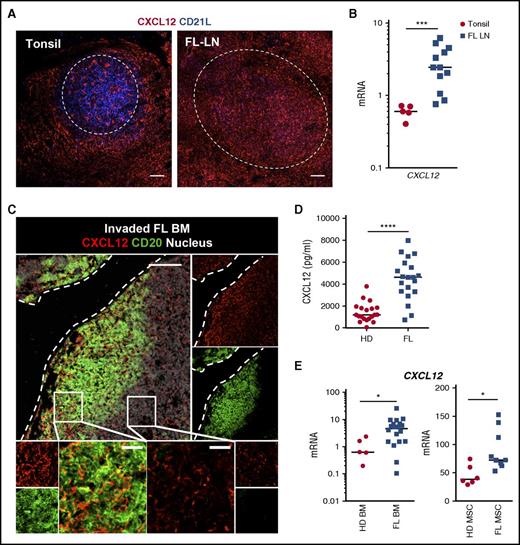 Figure 1. Expression of CXCL12 within FL cell niches. (A) Tonsil and FL LN sections were stained with mouse immunoglobulin G1 (IgG1) anti-CXCL12 and mouse IgM anti-CD21L antibodies followed by appropriate secondary antibodies. Dotted lines indicate normal and malignant follicles. Scale bar, 100 µm. (B) CXCL12 was quantified by RT-qPCR in frozen tonsil (n = 5) and FL-LN (n = 12) sections. (C) Sections from invaded FL BM were stained with mouse IgG1 anti-CXCL12 and rabbit anti-CD20 antibodies followed by appropriate secondary antibodies. Nuclei were counterstained with SytoxBlue (white). Dotted lines indicate the bone. Scale bar, 100 µm. Boxes indicate the areas magnified in lower panels, including intratumoral zone (left) and extratumoral zone (right); scale bar, 20 µm. (D) CXCL12 concentration was measured by enzyme-linked immunosorbent assay (ELISA) in BM plasma from HDs (n = 20) and FL patients (n = 20). (E) CXCL12 was quantified by RT-qPCR in whole BM cells (left) and BM-MSCs (right) obtained from HDs (n = 5 and n = 6, respectively) and FL patients (n = 20 and n = 9, respectively). ****P < .0001; ***P < .001; *P < .05.