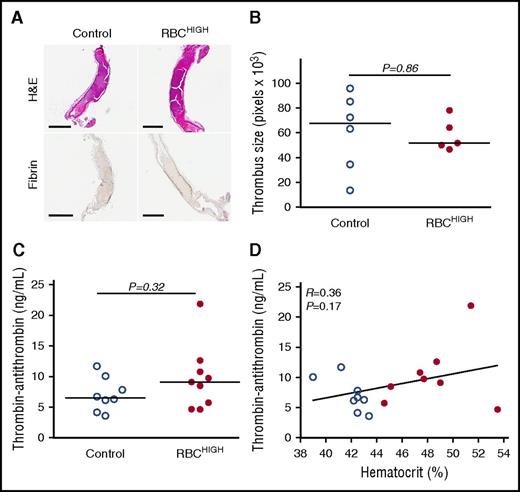 Figure 3. Following FeCl3 injury, control and RBCHIGH mice have similar thrombus morphology and similar levels of circulating TATc. (A-B) Thrombi from a subset of mice subjected to FeCl3-induced carotid artery thrombosis were excised, fixed in 10% formalin, transferred to 70% ethanol, and analyzed. (A) Hematoxylin and eosin (H&E) staining (upper panels) and immunohistochemistry for fibrin (brown staining; lower panels). Scale bars indicate 500 µm. (B) Thrombus size was determined by measuring pixel area of the thrombus within the vessel. (C) TATc were measured by enzyme-linked immunosorbent assay in plasmas from control (uninfused) and RBCHIGH mice following FeCl3-induced artery occlusion. (D) Relationship between hematocrit and TATc levels measured after FeCl3-induced artery occlusion in control (open circles) and RBCHIGH (closed circles) mice. In panels B-D, each dot is a separate mouse. In panels B-C, horizontal lines indicate medians.