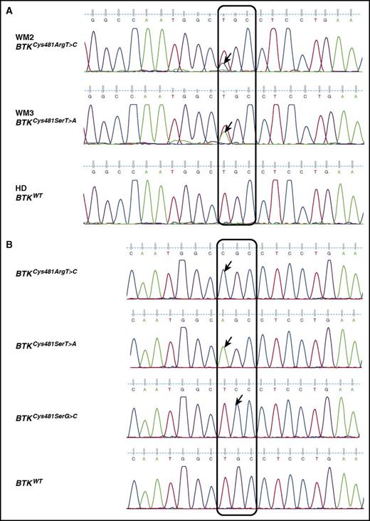 Figure 1. Representative Sanger sequencing traces for patients with BTKCys481 variants. (A) Sanger sequencing traces on CD19-sorted BM cells showing BTKCys481Arg(c.1634T>C) and BTKCys481Ser(c.1634T>A) variants in patients WM2 and WM3, respectively. (B) Representative Sanger sequencing traces from cloning and sequencing studies show the presence of multiple BTKCys481 variants in patient WM2. Cloning and sequencing analysis showed 17/107 (15.9%), 21/107 (19.6%), and 7/107 (6.5%) clones expressed BTKCys481Arg(c.1634T>C), BTKCys481Ser(c.1634T>A), and BTKCys481Ser(c.1635G>C), respectively, for patient WM2; whereas 2/119 (1.7%), 46/119 (38.7%), and 8/119 (6.7%) clones expressed BTKCys481Arg(c.1634T>C), BTKCys481Ser(c.1634T>A), and BTKCys481Ser(c.1635G>C), respectively, for patient WM3. Arrows denote nucleotide variants. HD, healthy donor.