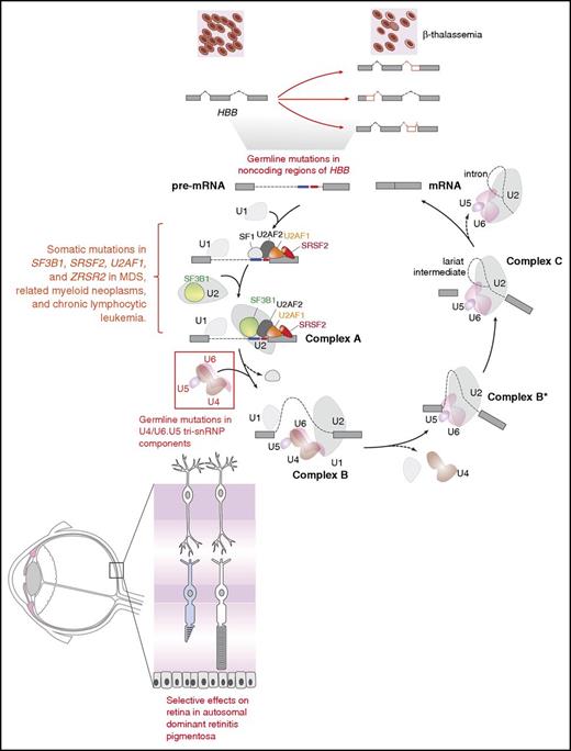 Figure 1. Diagram of the complexes involved in RNA splicing and how trans-acting mutations in splicing factors as well as mutations in sites required for splicing of genes in cis may result in tissue-specific phenotypic effects. The individual steps and components of each spliceosomal complex have been described recently in other reviews.58-62 Germ line mutations in the genes encoding 6 different members of the U4/U6.U5 tri-small nuclear ribonucleoprotein particle (tri-snRNP; red box) result in the retinal degenerative disorder known as autosomal dominant retinitis pigmentosa. Despite the ubiquitous expression of these proteins and their role in core RNA splicing function required in every cell, overt phenotypic effects of these mutations are only apparent within the retina. In contrast to the U4/U6.U5 tri-snRNP mutations in autosomal dominant retinitis pigmentosa, mutations in the RNA splicing factors SF3B1, U2AF1, SRSF2, and ZRSR2 are enriched in leukemias and subsets of epithelial malignancies. Again here, how mutations in core RNA splicing factors expressed in numerous cell types are enriched in diseases of specific lineages remains to be addressed. In addition to mutations in RNA splicing proteins, mutations in coding or noncoding regions are required for RNA splicing of a gene in cis. The earliest examples of such an alteration are the mutations within HBB that are well known to be associated with β-thalassemia. Despite the fact that such mutations may occur in the germ line, the direct phenotypic effects of these mutations are specific to the hematopoietic system given the importance of hemoglobin β to red blood cell function.