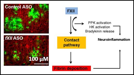 Coagulation FXII has an essential role in inflammation-mediated neuronal damage and cognitive impairment in an AD mouse model. Similar to depletion of fibrinogen, depletion of FXII decreases neuroinflammatory responses and subsequent brain pathology. Histological images have been adapted from Figure 6 in the article by Chen et al that begins on page 2547.