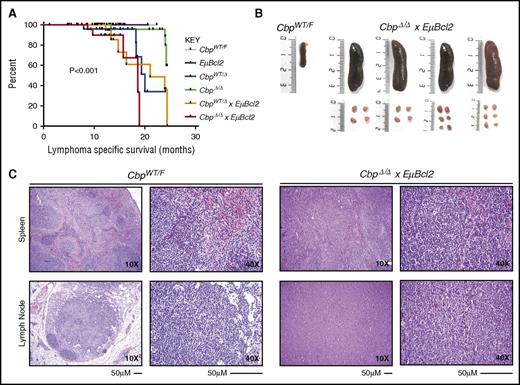 Figure 3. Crebbp deletion promotes B-cell lymphoma in tandem with Bcl2 overexpression. (A) A Kaplan-Meier plot shows the lymphoma-specific survival of 6 transgenic strains. It can be seen that deletion of 1 or both alleles of Crebbp leads to the development of lymphoma at a late time point in some mice, that the penetrance is increased and the latency is decreased with the addition of the EµBcl2 transgene. (B) An example of spleens and lymph nodes from CbpΔ/ΔxEµBcl2 mice that became ill, showing splenomegaly and lymphadenopathy that is indicative of lymphoma. (C) Hematoxylin and eosin staining from representative spleen and lymph node samples of age-matched tumor-free CbpWT/F and tumor-bearing CbpΔ/ΔxEuBcl2 mice. The B-cell lymphomas can be seen to be associated with a diffuse spread of centroblasts, with loss of normal architecture. Pathology review determined this specimen to be most similar to DLBCL histology.