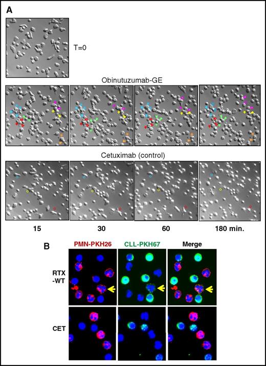 Figure 1. Microscopy images of PMNs cocultured with CLL B cells and anti-CD20 OBZ or CET control antibody. (A) Live-cell time-lapse microscopy experiments were performed with purified PMNs and CLL B cells at a 1:2 E:T ratio, cultured at 37°C in X-VIVO medium (Lonza) in the presence of 10 µg/mL of anti-CD20 OBZ-GE or CET control antibody. Time point 0 (T = 0): image taken at the start of the experiment before all CLL B cells had settled down to the bottom of the well. The other representative images were taken at ∼15, 30, 60, and 180 minutes after adding the indicated antibodies. Asterisks mark selected PMNs that repeatedly contacted the CLL B cells (indicated by arrowheads of the same color). Colored circles mark selected PMNs that made brief contact with CLL B cells in the control (CET) experiment. Original magnification ×400. The full videos of representative experiments in the presence of OBZ-GE (supplemental Video 1), CET (supplemental Video 2), RTX-WT (supplemental Video 3), RTX-GE (supplemental Video 4), and control beads (supplemental Video 5) are available on the Blood Web site. (B) Confocal microscopy images of PKH26-labeled PMNs (red) and PKH67-labeled CLL B cells (green) cocultured for 3 hours in the presence of 10 µg/mL of RTX-WT or CET control antibody. The yellow arrows indicate a representative red PMN that trogocytosed green PKH67 dye from CLL B cells. Original magnification ×630. Additional images are available (supplemental Figure 1).