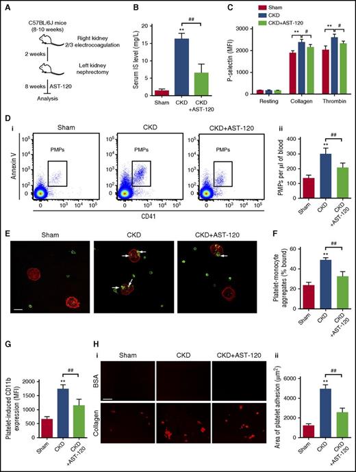 Figure 1. Platelet hyperactivation is detected in CKD mice possibly due to the high level of serum IS. (A) Scheme for creation of CKD mouse model and AST-120 treatment. (B) Serum IS levels were measured at 8 weeks after left nephrectomy (n = 8). (C) Flow cytometric analysis of P-selectin expression in platelets in response to 2 μg/mL collagen or 0.05 U/mL thrombin (n = 6). (D) Flow cytometric analysis of the concentration of PMPs in whole blood (i). Quantification of the number of PMPs per 1 μL of whole blood (n = 6) (ii). (B-D) Data are mean ± SD. **P < .01 vs sham group; #P < .05, ##P < .01 vs CKD group, ANOVA. (E) Representative immunostaining images of platelet-monocyte aggregates formation in vivo. The peripheral blood cells were labeled with anti-CD14 (red) and anti-CD41 (green), and visualized by confocal microscopy. Scale bar, 10 μm. White arrows indicate platelets associated with monocytes. (F) Flow cytometric analysis of the percentage of platelet-monocyte aggregates in whole blood in vivo (n = 6). (G) Flow cytometric analysis of platelet-induced CD11b expression in platelet-associated monocytes (n = 6). (H) Representative images of thrombus formation on a collagen-coated flow chamber under shear-flow conditions (i). Scale bar, 50 μm. Quantification of the area of platelet adhesion for each group (n = 6) (ii). (F-H) Data are mean ± SD. **P < .01 vs sham group; ##P < .01 vs CKD group, ANOVA. BSA, bovine serum albumin; MFI, mean fluorescence intensity.