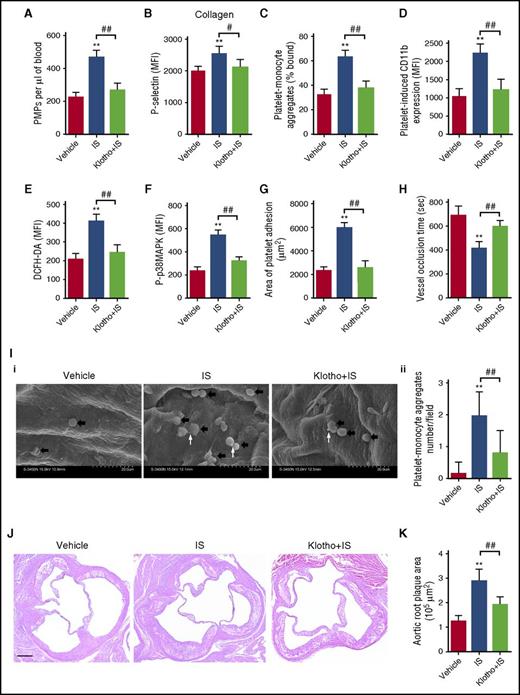 Figure 7. Klotho administration attenuates IS-induced thrombosis and atherosclerosis in apoE−/− mice. (A) Flow cytometric analysis of the concentration of PMPs in whole blood (n = 6). (B) Flow cytometric analysis of P-selectin expression in platelets in response to 2 μg/mL collagen (n = 6). (C) Flow cytometric analysis of the percentage of platelet-monocyte aggregates in whole blood in vivo (n = 6). (D) Flow cytometric analysis of platelet-induced CD11b expression in platelet-associated monocytes (n = 6). (E) Flow cytometric analysis of ROS levels in platelets (n = 6). (F) Flow cytometric analysis of the expression of P-p38MAPK in platelets (n = 6). (G) Quantification of the area of platelet adhesion for each group (n = 6). (H) The time for carotid artery occlusion by thrombus for each group (n = 6). (I) Representative images of platelet-monocyte aggregates adhesion on atherosclerotic endothelium as seen by SEM. Black arrows indicate leukocytes adhered on atherosclerotic endothelium. White arrows indicate platelets associated with leukocytes (i). Quantification of the number of platelet-monocyte aggregates for each group (n = 20 fields) (ii). (B-I) Data are mean ± SD. **P < .01 vs vehicle group, ##P < .01 vs IS group, ANOVA. (J) Representative cross-sections (hematoxylin and eosin staining) of the aortic sinus. Scale bar, 100 μm. (K) Quantification of the atherosclerotic plaque area in aortic root (n = 6). Data are mean ± SD. **P < .01 vs vehicle group, ##P < .01 vs IS group, ANOVA.