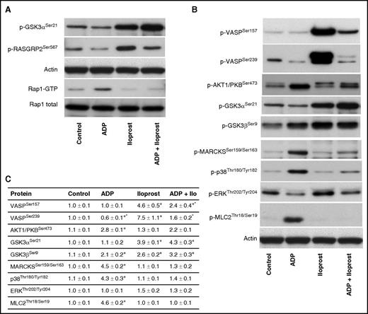 Figure 8. Western blot validation of inverse GSK3ASer21 , RASGRP2Ser567 phosphorylation, and RAP1 pull-down after stimulation with ADP, Iloprost, and ADP+Iloprost. (A) Human platelets (3 × 108/mL) were stimulated by ADP (10 μM, 1 minute), Iloprost (2 nM, 1 minute), or both; notably, slightly different than for the phosphoproteomics data. After stimulation, platelets were lysed and subjected to western blot GSK3ASer21, RASGRP2Ser567, and Rap1 pull-down assay. The representative blots of 3 independent experiments are shown. (B) Immunoblots using selected phosphospecific antibodies were done in triplicate and (C) quantified using the ImageJ program. The intensities of the phosphorylation signals were normalized to actin. Data are normalized against controls, results are given as means ± standard error of the mean (n = 3, + P < .05 compared with the control, *P < .05 compared with the Iloprost sample).