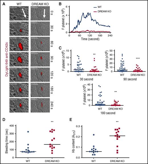 Figure 1. DREAM is required for platelet thrombus formation and hemostasis at the site of vascular injury in mice. Fluorescence intravital microscopy was performed as described in “Methods.” Following laser-induced injury of cremaster muscle arterioles, platelet accumulation was visualized by infusion of DyLight 649–labeled anti-mouse CD42c antibodies into WT or DREAM KO mice. (A) Representative images are shown over the course of 240 seconds after injury. Arrows show direction of blood flow. (B) The integrated median fluorescence intensities of anti-CD42c antibodies (F platelet) were obtained from 42 to 44 thrombi in 6 WT or 6 KO mice and are presented as a function of time. (C) Fluorescence intensities of anti-CD42c antibodies in WT and DREAM KO mice were compared at 30, 90, and 180 seconds after arteriolar injury. (D) Tail bleeding time was monitored by cutting 5 mm of the tail of WT (●) and DREAM KO (▪) mice (n = 13 mice). (E) Blood loss during the bleeding time assay was determined by measuring the absorbance at 575 nm of hemoglobin (Hb). **P < .01 and ***P < .001 vs WT mice after the Mann-Whitney U test. Horizontal bars represent the median value of the fluorescence intensities of anti-CD42c antibodies, bleeding times, or Hb content.
