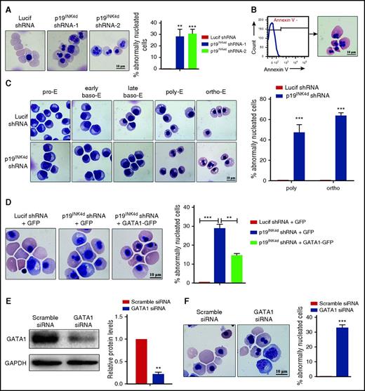 Figure 4. p19INK4d knockdown causes abnormal nuclear morphology of erythroblasts and ectopic GATA1 expression can reverse the abnormal phenotype. (A) Representative images of Lucif shRNA or p19INK4d shRNA-infected erythroblasts (day 15 cells) and quantitative analysis of cells with abnormal nuclei. (B) Flow cytometry analysis of sorted annexin V− erythroblasts (left). Representative images of sorted annexin V− erythroblasts (right). (C) Representative images of sorted erythroblasts at distinct development stages after Lucif shRNA or p19INK4d shRNA infection (left). Quantitative analysis of abnormal nuclear morphology of sorted erythroblasts at the polychromatic and orthochromatic stages from 3 independent experiments (right). (D) Representative images of erythroblasts infected with Lucif shRNA, p19INK4d shRNA, and p19INK4d shRNA combined with GATA1 overexpression (day 15 cells) (left). Quantitative analysis of nuclear morphology data from 3 independent experiments (right). (E) Representative images of western blotting showing GATA1 expression in erythroblasts transfected with GATA1 siRNA or scramble siRNA (day 15 cells) (left). Quantitative analysis of expression data from 3 independent experiments (right). GAPDH was used as a loading control and the results were normalized to GAPDH protein. (F) Representative images of erythroblasts (day 15 cells) transfected with GATA1 siRNA or scramble siRNA (left). Quantitative analysis of nuclear morphology data from 3 independent experiments (right). The percentage of abnormally nucleated cells = counts of abnormally nucleated cells in 2000 cells/2000. Statistical analysis of data from 3 independent experiments and bar plot represents mean ± SD of triplicate samples. **P < .01, ***P < .001.
