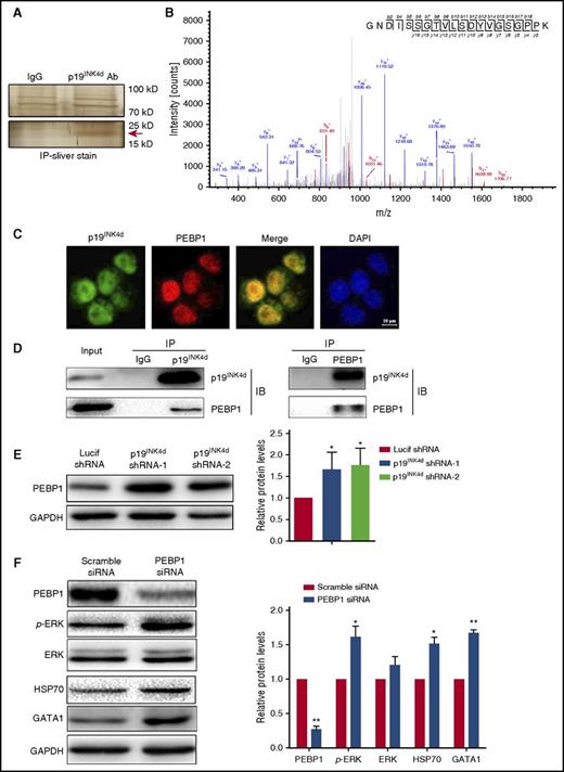 Figure 6. p19INK4d interacts with and negatively regulates PEBP1 and PEBP1 links p19INK4d with the ERK pathway. (A) Representative images of silver-stained gels of IP proteins using IgG and p19INK4d antibody. (Upper) Nonspecific bands; (lower) specific band is marked with a red arrow. (B) Representative electrospray ionization-MS and MS/MS profiling of a tryptic peptide that owns higher content. The top right corner is the amino acid sequence of this peptide and the specific amino acid sequence belongs to PEBP1 through identification of proteins from the protein database. (C) Representative immunofluorescence images showing p19INK4d and PEBP1 localization in erythroblasts. DAPI was used to stain the nucleus. (D) Representative images of co-IP experiments with a p19INK4d (left) or PEBP1 antibody (right). (E) Representative images of western blotting showing PEBP1 expression in erythroblasts infected with Lucif shRNA or p19INK4d shRNA (left). Quantitative analysis of western blotting data from 3 independent experiments (right). GAPDH was used as a loading control and the results were normalized to GAPDH protein. (F) Representative images of western blotting showing PEBP1, p-ERK, ERK, HSP70, and GATA1 levels in erythroblasts transfected with PEBP1 siRNA or scramble siRNA (left). Quantitative analysis of western blotting data from 3 independent experiments (right). GAPDH was used as a loading control and the results were normalized to GAPDH protein. Statistical analysis of data from 3 independent experiments and bar plot represents mean ± SD of triplicate samples. * P < .05, ** P < .01.