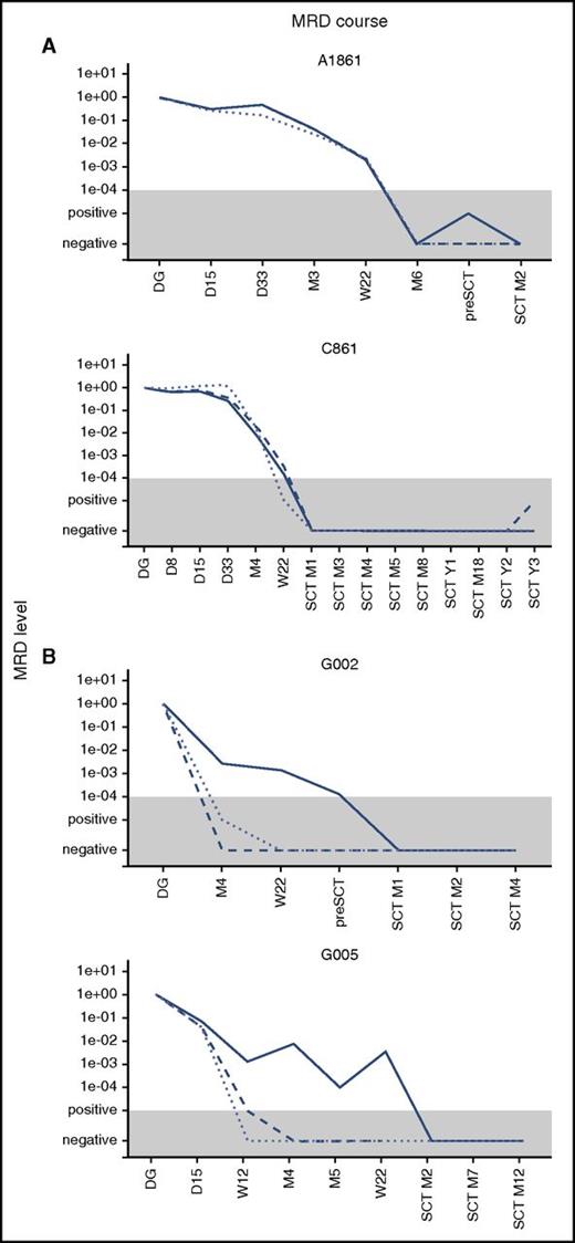 Figure 2. Examples of the MRD course. Examples of the MRD course measured by Ig/TCR (dashed line), BCR-ABL1 genomic breakpoint (full line), and IKZF1 deletion (dotted line) quantification in 2 illustrative patients with concordant MRD (A) and 2 with discordant MRD (B). The gray area represents the level of sensitivity of the Ig/TCR quantification. M, month (from the start of treatment or from SCT).