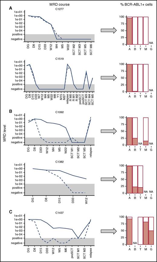 Figure 3. Presence of BCR-ABL1-positive cells in hematopoietic lineages. Presence of BCR-ABL1-positive cells in hematopoietic lineages (A, ALL blasts; B, non-ALL B cells; G, granulocytes; M, myeloid cells/monocytes; T, T cells) at diagnosis in ALL patients with concordant (A) and discordant (B) MRD courses and in CML patient (C). The MRD levels are shown for Ig/TCR (dashed line) and BCR-ABL1 genomic breakpoint (full line); the gray area represents the level of sensitivity of the Ig/TCR quantification. NA, not available.