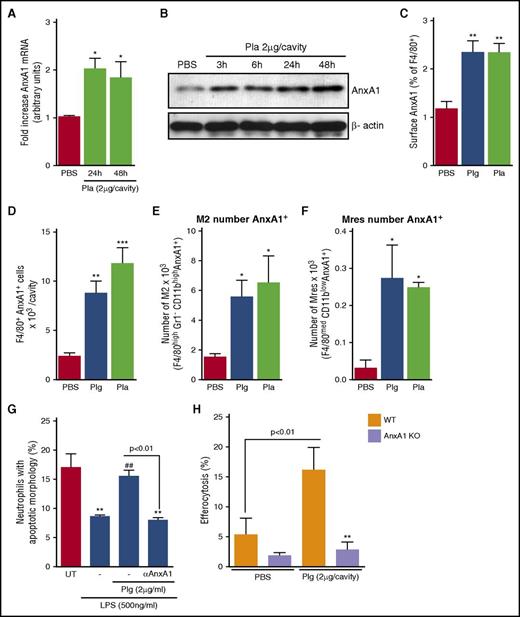 Figure 6. Involvement of AnxA1 in Plg/Pla-induced apoptosis and efferocytosis. BALB/c mice were challenged with an i.pl. injection of Pla (2 µg per cavity) or PBS (vehicle). The cells that migrated to the pleural cavity were collected 3, 6, 24, and 48 hours after challenge and analyzed for AnxA1 mRNA expression by qRT-PCR (A), protein expression by western blot (B), and cell surface externalization by flow cytometry (C-F). Pleural cells obtained 48 hours after injection of Plg/Pla were surface stained and gated on F4/80-positive cells, and then analyzed for AnxA1. Data report the percentage (C) and the absolute number (D) of cells positive for AnxA1. Pleural cells were gated as in Figure 1, and then M2 (E) and Mres (F) subpopulations of macrophages were analyzed for AnxA1. Data are mean ± SEM. *P < .05; **P < .01; ***P < .001 when compared with mice injected with PBS. Neutrophils isolated from peripheral blood of healthy human donors were cultured in 96-well cell culture plates (106 cells per well) with or without anti-AnxA1 antiserum (8 µg of hyperimmune serum per well) for 1 hour, and then treated with LPS (500 ng/ml) or LPS plus Plg (2 µg/ml) for an additional 5 hours. Cytospin slides of neutrophils were counted for apoptosis. **P < .01 when compared with untreated (UT) neutrophils; ##P < .01 when compared with the LPS-treated group. The experiments were performed twice with different donors in biological triplicates (G). WT and AnxA1 KO mice received an i.p. injection of zymosan, and were injected i.p. 62 hours later with Plg (2 µg per cavity) or vehicle. Seven hours after treatment, mice were injected i.p. with 106 apoptotic neutrophils. Mice were killed 3 hours after injecting prey neutrophils (see the schematic representation of experimental protocol in Figure 5). Efferocytosis was assessed on cytospin preparations of cells harvested from peritoneal lavage. Results are presented as the mean efferocytosis index ± SEM of 5 mice. **P < .01 comparing Plg-treated WT mice vs Plg-treated Anx1 KO mice (H). qRT-PCR results are presented as the fold increase of mRNA expression relative to the amount present in control samples. Analyses of gene expression were performed with 2 replicates with samples of all groups run on 1 plate. Blots were normalized with β-actin and are representative of 3 independent experiments using pooled cells from at least 5 animals. All experiments were performed at least 3 times with similar results.