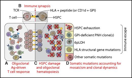 Somatic mutations, hematopoietic mosaicism, and clonal dynamics in immune-mediated AA. (A) From the polyclonal T-cell repertoire, some clonal T cells specific for some antigen expressed on HSPCs (see “Immune synapsis”) may expand, leading to an oligoclonal antigen-driven T-cell response. (B) The immune synapsis: T cells may recognize through their T-cell receptor–specific antigens, presented on (some) HSPCs within either HLA alleles (peptidic epitopes) or HLA-like molecules (for lipidic epitopes; this is the case as with the GPI anchor presented within CD1d).6,7 (C) Pathogenic T-cell clones may exert T-cell–mediated cytotoxicity over many HSPCs (via the immune synapsis depicted in the inset), eventually leading to oligoclonal hematopoiesis.2,4 (D) Different somatic mutations may stochastically occur within individual HSPCs; because of the underlying HSPC oligoclonality, any neutral mutation carried by surviving HSPCs becomes evident (Darwinian selection).9 Individual mutations leading to specific functional phenotypes shape the subsequent hematopoietic mosaicism and clonal dynamics through different mechanisms, including immune escape, HSPC fitness, or proliferative advantage. In the absence of somatic mutations, HSPCs may undergo exhaustion (first quadrant). Expansion of clones escaping the immune response may occur through different mechanisms, such as GPI-deficient cells (PNH, second quadrant)6 or functional loss of HLA due to 6pLOH (third quadrant) or to other structural HLA gene mutations (ie, B4002− cells).1 Other somatic mutations may contribute to clonal dominance through distinct specific mechanisms (fifth quadrant)10: true malignant transformation for splicing genes, survival/growth advantage, or increased HSPC fitness for epigenetic mutations; unknown (possibly immune escape?) for BCOR-BCORL1 mutations. Ag, antigen; TCR, T-cell receptor. Professional illustration by Somersault18:24.
