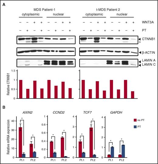 Figure 6. Pyrvinium suppresses WNT activation in MSCs isolated from patients with myeloid neoplasms with a del(5q). (A) MSCs were isolated from the BM of 2 del(5q) patients with primary MDS or t-MDS and were treated in vitro with or without 50 ng/mL WNT3A ± 50 nM PT, as indicated, for 16 hours. Nuclear and cytoplasmic fractions were isolated and immunoblotted with antibodies specific for CTNNB1, β-actin, and Lamin A/C. Quantitation of the immunoblots revealed a ∼50% reduction in CTNNB1 levels in samples treated with PT. *A smaller CTNNB1 degradation product. (B) Patient MSCs were treated with WNT3A ± 50 nM PT for 16 hours. RNA was isolated and transcribed to cDNA, and PCRs (run in triplicate) were quantified using Fast-SYBR Green. Gene expression was normalized to the ACTB gene and data are presented as mean ± SEM of 1 patient sample, run in triplicate. PT significantly decreased WNT3A-mediated transcription of WNT target genes, but not the control GAPDH gene. *P < .05. Increased GAPDH may reflect emerging evidence suggesting that GAPDH gene expression can be modulated by external factors.58