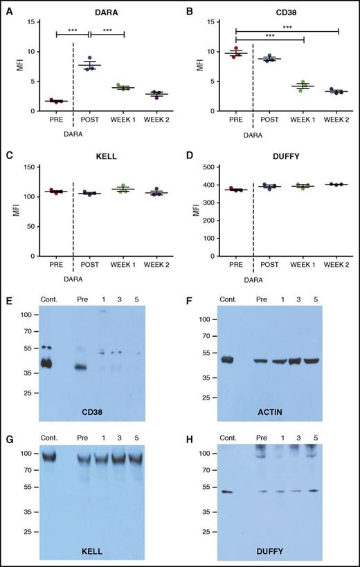 Figure 2. CD38 antigen and bound antibody specifically decline following DARA treatment. (A-D) Bound DARA (ie, flow cytometry–based DAT) (A), CD38 antigen (B), Kell antigen (C), and Duffy antigen (D) before and after initial DARA administration (post, same day as administration; week 1, 1 week after initial administration; week 2, 2 weeks after initial administration). (E-H) Western blot analysis of the CD38 antigen (E), β-actin (F), Kell antigen (G), and Duffy antigen (H) before and after DARA administration (1, 1 week following initial administration; 3, 3 weeks following initial administration; 5, 5 weeks following initial administration). Each time point consists of 3 repeat runs of the same sample. Dotted line represents first DARA administration. Significance was determined in panels A-D by 1-way analysis of variance with Tukey post-test (***P ≤ .001).