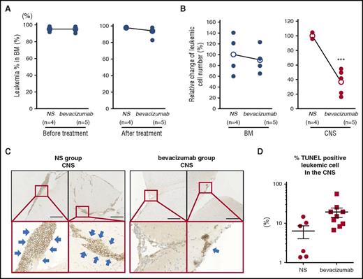 Figure 2. Effect of bevacizumab on the leukemic cell burden in the CNS of xenograft recipients. Leukemic mice showing >90% engraftment in the BM received intraperitoneal bevacizumab or normal saline (NS). (A) Mean burden of leukemic cells in the BM of each group at the start and the end of treatment. (B) Mean burden of leukemic cells in the BM and CNS of each group at the end of treatment showing significant lower leukemic cells in the CNS of bevacizumab-treated mice. Data show mean and analyzed with 2-sided, unpaired Student t test; ***P < .001. (C) Representative immunohistochemical staining for human CD19 in tissue sections from the CNS of NS- and bevacizumab-treated mice. Thick blue arrows mark leukemic cells. Scale bar, 250 μm. (D) The percentage of TUNEL-positive leukemic cells in the CNS was counted from 3 distinct areas of the each section of 2 control mice and 3 bevacizumab-treated mice. Graph shows the percentage of TUNEL-positive cells in the CNS.