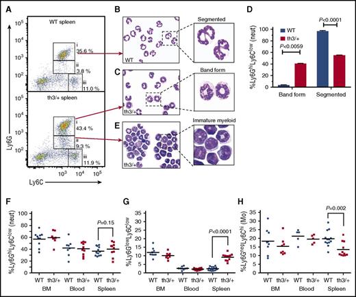 Figure 4. Hbbth3/+ mice have an increased number of immature neutrophils in the spleen. (A) Representative dot plot analysis of CD11b+CD49bneg cells showing (i) neutrophils (Ly6GhighLy6Clow), (ii) immature myeloid cells (Ly6GlowLy6Clow), and (iii) monocytes (Ly6GnegLy6Chigh) in the spleen of WT and Hbbth3/+ mice. Morphological analysis of Ly6GhighLy6Clow neutrophils from the spleen of (B) WT and (C) Hbbth3/+ mice, stained with May-Grünwald-Giemsa stain (original magnification ×400; enlarged insets digitally expanded from the ×400 images). (D) Percentage of band form and segmented cells among the sorted Ly6GhighLy6Clow neutrophils in the spleen of WT and Hbbth3/+ mice. Results are presented as mean and SEM of n = 5. (E) Morphological analysis of immature myeloid cells sorted from the spleen of Hbbth3/+ mice and stained with May-Grünwald-Giemsa stain (original magnification ×400; enlarged inset digitally expanded from the ×400 image). Relative abundance of (F) neutrophils (Ly6GhighLy6Clow), (G) immature myeloid cells (Ly6GlowLy6Clow), and (H) monocytes (Ly6G−Ly6Chi) in BM, blood, and spleen of WT and Hbbth3/+ mice (among CD11b+CD49bneg cells). Shown are results from individual animals, with horizontal line indicating mean for each group. The statistical significance between the groups was evaluated with Student t test.