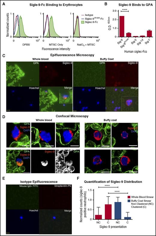 Figure 4. GPA, the major surface sialoglycoprotein on erythrocytes, engages Siglec-9 via sialic acids. (A) Treated (NaIO4/MTSC), mock treated (MTSC only), and untreated (DPBS) erythrocytes were evaluated for the binding of Siglec-9-Fc and analyzed by flow cytometry. Isotype control (goat anti-human IgG); n = 4. (B) Five human recombinant Siglec-Fcs were measured for their ability to bind immobilized GPA by enzyme-linked immunosorbent assay; n = 3. Statistics were analyzed by ordinary 1-way ANOVA. ****P < .0001 versus control values considered statistically significant. (C) Smears prepared immediately after drawing whole blood (left) or those prepared from buffy coat (right), fixed and costained for the erythrocyte GPA (green), Siglec-9 on neutrophils (red), and nucleus (Hoechst). Clustering (Merge) of GPA with neutrophils Siglec-9 upon contact (1 representative image of each shown). Scale bar, 10 μm. (D) Smears were stained similarly as in panel C and analyzed by confocal microscopy. Whole-blood smears (left) confirm polarized clustering of Siglec-9 on neutrophils toward GPA-covered red blood cells (4 representative patterns are shown). One staining pattern in which GPA colocalizes with Siglec-9 (lower left); individual GPA and Siglec-9 channels are in black and white. Scale bars, 5 µm. (E) Isotype controls were stained with streptavidin-PE, mouse IgG1-FITC, and Hoechst stain. Scale bar, 10 μm. (F) Siglec-9 clustering and nonclustering in neutrophils from epifluorescent blood smears were counted and normalized to the total number of Siglec-9 positive neutrophils. Representative images from panel C or pooled data percentage (normalized to Siglec-9 positive cells) are shown (+/− standard error of the mean). Statistical analysis was performed using ordinary 1-way ANOVA with Holm–Sidak's multiple comparison test. ****P < .0001. DAPI, 4′,6-diamidino-2-phenylindole; O.D., optical densitiy; Sig, Siglec.