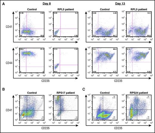 Figure 2. Characterization of erythroid differentiation during in vitro culture. Flow cytometric analysis of cultured CD34+ cells labeled with CD235, CD44, and CD41 antibodies. (A) Control donor and a patient with an RPL5 mutation at day 8 and day 13 of terminal erythroid differentiation. (B) Control donor and a patient with a RPS17 mutation at day 14 of culture. (C) Control donor and a patient with a RPS24 mutation at day 14 of culture.