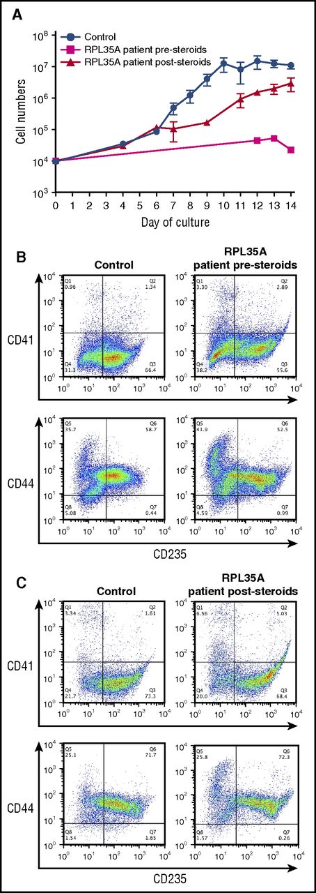 Figure 3. Improved proliferation and erythroid differentiation in a steroid-treated patient. (A) Growth curves of CD34+ cells from control donors (n = 24) and a DBA patient with a deletion in chromosome 3q29 containing the RPL35A gene before (magenta; n = 2) and after (red; n = 3) treatment with prednisolone. The data are presented as the mean ± standard error of the mean. (B, C) Flow cytometric analysis of terminally differentiated erythroid cells from a control donor and from a patient with a deletion in chromosome 3q29 using antibodies against CD41, CD44, and CD235 before steroid treatment (B) and after steroid treatment (C).