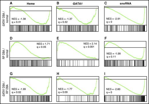 Figure 6. GSEA of CD235− cells. (A-I) Comparison of the transcriptome of normal CD41−/CD44+/CD235− cells to those from GATA1- or RP-mutated DBA patient CD41−/CD44+/CD235− cells, as well as differences in direct comparison of RP and GATA1 specimens, by GSEA. Genes are ranked by signal-to-noise ratio according to differential expression, with the position of genes comprising each set (heme, GATA1, snoRNA) illustrated by the vertical black bars below the plot in each comparison. Overrepresentation of genes from a set at the top (left) or bottom (right) of the ranked list indicates over- and underexpression and is illustrated by a peak (positive) or valley (negative) in the running enrichment score (green) shifted to the left or right, respectively. The gray line represents no change. The normalized enrichment score and false discovery rate q-value are shown for each comparison illustrated. Evaluation of heme synthesis genes (from the MSigDB hallmark set) demonstrated (A) modest downregulation in GATA1-mutated samples when compared with normal controls that was not statistically significant but showed significant overexpression in RP-mediated DBA in comparison with normal controls (D) and GATA1-mutated patients (G). Patients with GATA1 mutations did not show underexpression of any tested GATA1 gene set (B; GATA1 TRANSFAC set from Ref. 26 illustrated), whereas patients with RP mutations showed marked and statistically significant GATA1 target gene overexpression in comparison with both normal controls and patients harboring GATA1 mutations (E, H; GATA1 GSE628 set from Ref. 26 illustrated). Similarly, evaluation of small nucleolar RNA transcription (gene set derived from all snoRNA annotated on the array) showed highly significant downregulation in patients with GATA1 mutations in comparison with normal controls (A) and DBA patients with RP mutations (I), but no significant changes in expression of RP-mediated DBA patients when compared with normal controls (F). NES, normalized enrichment score.
