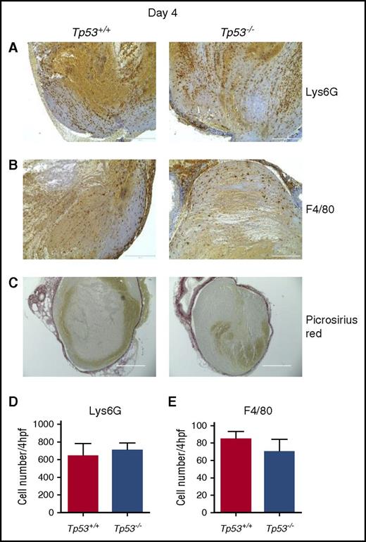 Figure 2. Characterization of venous thrombi from Tp53+/+ and Tp53−/−mice at 4 days after vena cava ligation. Immunohistochemical analysis of intrathrombotic neutrophil accumulation was performed using anti-Lys6G antibodies (A) and macrophage accumulation was analyzed using anti-F4/80 antibodies (B) in venous thrombus samples from Tp53+/+ and Tp53−/− mice. (C) Collagen content in resolving Tp53+/+ and Tp53−/− thrombi at day 4 was determined in histological sections after Picrosirius Red staining; original magnification ×200. Scale bar, 200 μm. Representative results from 4 to 5 independent animals are shown. The numbers of Lys6G+ cells (neutrophils) (D) and F4/80+ cells (macrophages) (E) were determined as described in “Methods.” All values represent the mean ± standard error of the mean (SEM) (n = 4 Tp53+/+ and 5 Tp53−/−).