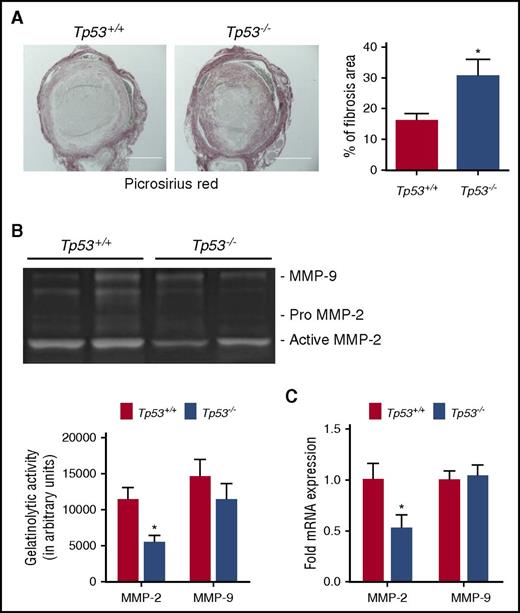 Figure 3. Effect of p53 deficiency on collagen remodeling. (A) Collagen content in resolving Tp53+/+ and Tp53−/− thrombi at day 12 was determined in histological sections after Picrosirius Red staining; original magnification ×100. Scale bar, 400 μm. Representative images from 5 independent mice from each genotype are shown. Collagen content was quantified as a measure of fibrosis as described in “Methods.” All values represent the mean ± SEM (n = 5 Tp53+/+ and 5 Tp53−/−). *P < .05, Tp53+/+ vs Tp53−/−. (B) Representative gel images of intrathrombotic MMP-2 and MMP-9 activities in venous thrombus samples from Tp53+/+ and Tp53−/− mice as measured by gelatin gel zymography (n = 5 and 4 for Tp53+/+ and Tp53−/−, respectively). Gel images were subjected to semiquantitative analysis as described in “Methods.” All values represent the mean ± SEM (n = 4-5 per group). *P < .03, Tp53+/+ vs Tp53−/−. (C) Intrathrombotic mRNA expression of MMP-2 and MMP-9 in Tp53+/+ and Tp53−/− mice at day 8 was determined by quantitative PCR (qPCR). All values represent the mean ± SEM (n = 4 per group). *P < .03, Tp53+/+ vs Tp53−/−.