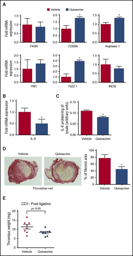 Figure 7. Quinacrine treatment alters intrathrombotic macrophage polarization and fibrosis. (A) Intrathrombotic mRNA expression of macrophage polarization markers at day 12 after vena cava ligation following treatment with vehicle or quinacrine, as determined by qPCR. All values represent the mean ± SEM (n = 4 vehicle and 4 quinacrine). *P < .05, vehicle vs quinacrine. (B) Intrathrombotic expression of IL-6 mRNA at day 12 after vena cava ligation following treatment with vehicle or quinacrine by qPCR. Values represent the mean ± SEM (n = 4 vehicle and 4 quinacrine). *P < .05, vehicle vs quinacrine. (C) Intrathrombotic expression of IL-6 protein at day 12 was determined by ELISA. All values represent the mean ± SEM (n = 4 vehicle and 4 quinacrine). **P < .05, vehicle and vs quinacrine. (D) Histochemical analysis of intrathrombotic collagen content by Picrosirius Red staining after treatment with vehicle or quinacrine at day 12 after vena cava ligation; original magnification ×100. Representative images from 4 to 5 independent mice of each group. The intrathrombus collagen area was quantified as a measure of fibrosis as described in “Methods.” All values represent the mean ± SEM (n = 4 vehicle and 5 quinacrine). *P < .05, vehicle vs quinacrine treated. (E) Effect of quinacrine treatment on established thrombi. CD-1 mice were treated with vehicle or quinacrine from 3 days post–vena cava ligation, and thrombus weights measured at 12 days after vena cava ligation (n = 8 vehicle and 9 quinacrine). *P < .05, vehicle vs quinacrine.