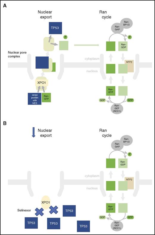 XPO1 inhibition prevents export of tumor-suppressor genes from the nucleus. (A) XPO1 mediates leucine-rich NES transport of tumor-suppressor proteins such as TP53 from the nucleus to the cytoplasm. This enhances leukemia cell survival. (B) Selinexor inhibits XPO1 function, leading to nuclear accumulation of TSPs, such as TP53, that can induce leukemia cell death.