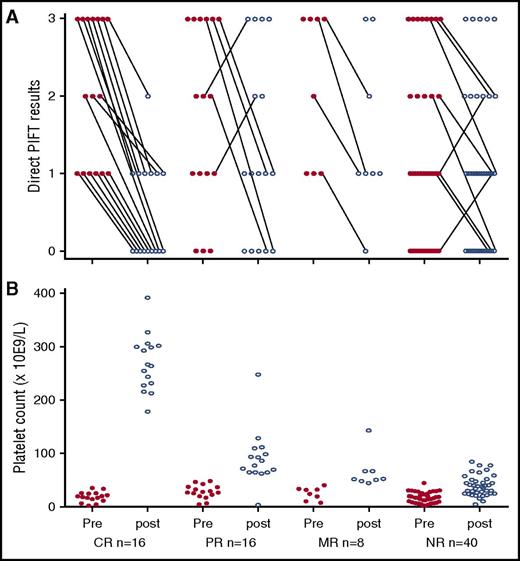 Figure 1. Direct PIFT results and platelet counts prior to initiation with rituximab and at the time of the highest platelet counts reached within 10 weeks after start of rituximab treatment of 80 serially tested ITP patients. X-axis for panel B also applies for panel A. (A) CR, n = 16; PR, n = 16; MR, n = 8; NR, n = 40. Direct PIFT scores before (pre) and at the time of the highest platelet count within 10 weeks after (post) treatment with rituximab: 0, negative; 1, positive; 2, strong positive; and 3, very strong positive. Changes in antibody detection results are indicated by means of connecting lines. (B) Platelet counts before and the highest platelet count within 10 weeks after treatment with rituximab.