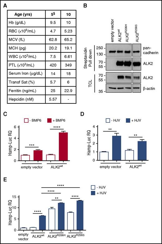 Figure 1. ALK2 mutants increase hepcidin expression in vitro. (A) Hematologic parameters of the proband at 5 and 10 years of age. §Hematologic data at age 5 years are from De Falco et al.13 Hb, hemoglobin; MCH, mean corpuscular hemoglobin; MCV, mean corpuscular volume; PTL, platelet; RBC, red blood cell; Transf Sat, transferrin saturation; WBC, white blood cell. (B) Plasma membrane localization of wild-type ALK2 (ALK2wt), ALK2R206H, and ALK2R258S was studied in HeLa cells labeled with a membrane-impermeable biotin. Cell-surface proteins were pulled down by using streptavidin beads and loaded onto a 10% sodium dodecyl sulfate polyacrylamide gel electrophoresis. ALK2 was detected by using the anti-FLAG antibody. Plasma membrane protein pull down and loading were normalized using anti–pan cadherin antibody. TCL, total cell lysates. (C-D) Hep3B cells were transfected with the hepcidin promoter luciferase (Hamp-Luc) vector, thymidine kinase promoter–Renilla luciferase reporter plasmid for normalization, ALK2wt, or empty vector and incubated with BMP6 (1 ng/mL) for 18 hours (C) or cotransfected with HJV (D). Forty-two hours after transfection, cells were lysed, and luciferase activity was measured. (E) Hep3B cells were transfected with HJV as described in panel D in the presence of ALK2wt or ALK2R206H or ALK2R258S mutant. All the experiments were performed 3 times in triplicate. A representative experiment is shown for each panel. **P < .01; ***P < .001; ****P < .0001. RQ, relative quantification.
