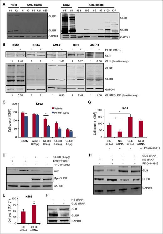 Figure 3. GLI3 is downregulated in AML and GLI3R is a critical regulator of Hh signaling in AML. (A) Western blotting was used to measure GLI3 protein levels in clinical specimens from patients with AML and normal bone marrow (NBM). Glyceraldehyde-3-phosphate dehydrogenase (GAPDH) was used as a loading control. Compared with NBM, AML samples showed significantly lower GLI3 levels. (B) AML cell lines and primary AML blasts were treated with PF-04449913, and cell lysates were analyzed for GLI1 and GLI3 protein levels. SMO antagonist increased the GLI3R:GLI3F ratio in responsive KG1 cells and primary AML11 blasts with no change in nonresponsive K562 and KG1a cells and primary AML2 blasts. PF-04449913 decreased GLI1 levels in KG1 and AML11 cells as shown by GLI1 densitometry. GAPDH was used as a loading control in all experiments. Densitometry analysis was done by using Image Studio Lite software. (C) K562 cells were transiently transfected with empty and Myc-tagged GLI3R constructs (0, 0.25, 0.5, 0.75, and 1 μg) followed by PF-04449913 treatment. Forced expression of GLI3R at 0.5 μg significantly reduced cell viability, which was additionally reduced after PF-04449913 treatment. *P < .05. (D) After cells were transfected with the indicated constructs and treated with PF-04449913, cell lysates were prepared and subjected to immunoblotting with anti-GLI1, anti-Myc, and anti-GAPDH antibodies. (E-F) K562 cells were transiently transfected with iLenti-si-Gli3 siRNA. NS scrambled siRNA was used as control. Cell viability was tested by trypan blue exclusion assay. *P < .05 vs NS siRNA control. Transfection efficiency of GLI3 siRNA was measured by western blotting by using GLI3 antibody. (G- H) KG1 cells were transfected with iLenti-si-Gli3 siRNA followed by treatment with PF-04449913. NS scrambled siRNA was used as control. Cell viability was tested by trypan blue exclusion assay. *P < .05. GLI1 and GLI3 protein levels were measured by western blotting. GAPDH was used as a loading control.