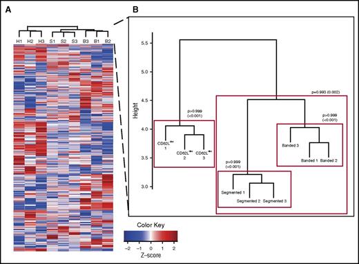 Figure 3. Hierarchical clustering of protein expression data. (A) Heatmap of normalized protein expression profiles. (B) Hierarchical clustering of non-normalized protein expression using averages clustering on a Euclidean distance matrix. Clusters were tested for statistical significance using multiscale bootstrapping, which revealed 4 statistically significant clusters (indicated by red boxes): 1 for each neutrophil subset and 1 for the banded and segmented neutrophils together. P values are approximately unbiased (AU; ie, an AU P value of .95 indicates that the existence of 2 clusters is supported by the data with 95% confidence). Numbers between brackets indicate the standard error of the AU P value estimation.