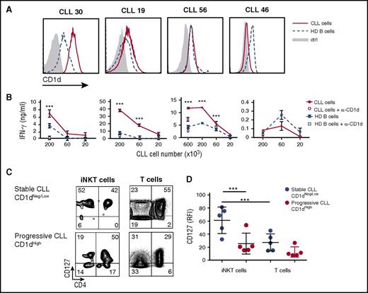Figure 3. Differential recognition of CLL and healthy B cells by iNKT cells. (A) CD1d expression by flow cytometry in primary CLL cells and B cells from 4 patients and 4 healthy donors, respectively, used in pairs for iNKT cell activation. (B) The same paired cells were cultured for 48 hours at the indicated numbers with 2 × 104 iNKT cells from healthy donors with or without anti-CD1d (α-CD1d) mAb. IFN-γ release by iNKT cells was measured by ELISA and expressed as mean ± SD. (C) Ex vivo CD127 expression determined by flow cytometry in patients with CD1dneg/low stable CLL vs patients with CD1dhigh progressive CLL. The percentage of CD127-expressing iNKT and T cells is indicated. (D) Frequency of CD127 iNKT and T cells from patients with stable or progressive disease. Graph symbols show single individual values ± SD. ***P < .0005 1-way ANOVA.