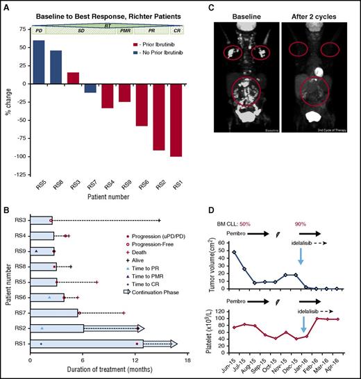 Figure 1. Changes in tumor burden, duration of therapy, and representative PET response in patients with RT receiving pembrolizumab. (A) The maximal percentage alteration in tumor burden from baseline in 9 RT patients. One patient (RS9), met the criteria for a PMR without having a 50% decrease in tumor burden but with a significant reduction of PET avidity. The color of each bar indicates whether a patient had prior ibrutinib therapy. (B) The response onset, and duration of therapy and DOR in RT patients. The length of the bar shows the time until the patient had a CR or a PR, along with the duration of the response and duration of therapy. Two patients (RS3 and RS7) who had SD, elected to discontinue the study in order to undergo alternative therapy. Three patients (RS1, RS2, and RS9) continued to receive pembrolizumab at the time of this report. Two patients (RS1 and RS2) had been added a signal inhibitor in addition to pembrolizumab (indicated by a blue arrow for the continuation phase) due to CLL progression in marrow (RS2) or a single locus RT progression detected on PET (RS1) (indicated by a solid red circle). RS1 had a DOR of 11 months for single-agent pembrolizumab and then received local radiation directed to one site of progression. He subsequently had a second CR and has maintained a CR with resumed pembrolizumab for 16 months of total therapy by the time of this report. RS2 had a DOR of 5 months for single-agent pembrolizumab and was then added idelalisib, and had pembrolizumab therapy for 12 months by the time of this report. RS6 had a DOR of ∼2 months before CLL marrow progression, leading to G3 thrombocytopenia. He came off therapy and received palliative care before the trial was amended to add a signal inhibitor. RS9 was in a sustained response of 3 months before the analysis cutoff. (C) The representative whole body PET images in RS2 at baseline prior to trial therapy and at the time point after 2 cycles of pembrolizumab treatment. The PET avid diseases were circled in these two PETs to compare the changes of PET-avid tumor. (D) The alteration of tumor burden and platelet count with the duration of therapy in RS2 during the single-agent therapy of pembrolizumab and the double-therapy of pembrolizumab with idelalisib. Arrow indicates the ongoing therapy. Trapezoid sign indicates a brief interruption of pembrolizumab due to thrombocytopenia.