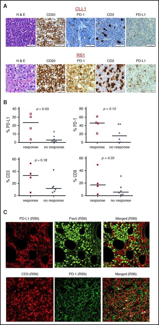 Figure 3. Biomarker assessment of PD-1/PD-L1 expression and tumor-infiltrating T cells in treated patients. (A) The expression of PD-1, PD-L1, CD3, and CD20 detected by standard IHC in one representative RT- and one CLL-involved lymph node are shown in images taken using 40× visual field with magnification ×400. Scale bars = 50 μm. (B) The percentage of expression of PD-1, PD-L1, CD3, and CD8 in the baseline lymph nodes/tumors of 10 patients (6 RT and 4 CLL). PD-L1 expression is significantly increased (P = .03 by 2-tailed Student t test using 2-sample equal variance). PD-1 expression shows a trend for an increased level of expression (P = .10) in RT patients who have confirmed response in comparison with the CLL/RT patients who do not have confirmed responses. CD3 and CD8 expression are not different in these above 2 cohorts. Line represents median expression levels of individual antigens. Each open/filled square or triangle represents the % expression of individual antigen in 1 patient. (C) The representative images of PD-1 staining (green) in conjunction with CD3 (red) and PD-L1 expression (red) in conjunction with Pax 5 (green), tested in dual-color immunofluorescent staining using confocal microscopy. PD-L1 has minimal colocalization with Pax5-positive B cells (supplemental Table 2) and PD-L1–positive cells have the morphology of monocytic/histiocytic lineages. PD-1 partially colocalized with CD3, whereas the majority of PD-1 staining appears to be positive on tumor B cells (supplemental Table 2). Arrows point to the colocalization. Images were taken using 40× visual field with magnification ×400. H&E, hematoxylin and eosin.