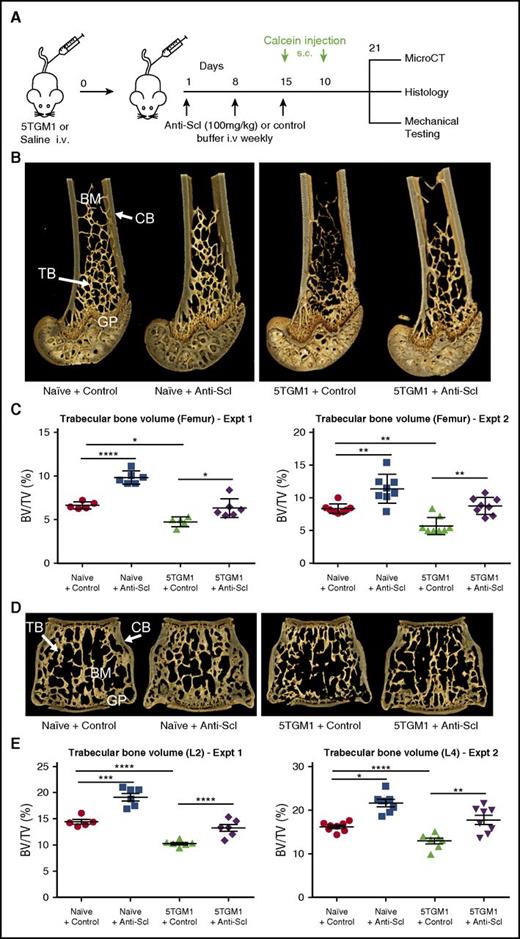 Figure 2. Treatment with anti-sclerostin antibody prevents myeloma-induced bone loss in the 5TGM1 murine model of myeloma. (A) Schematic depicting study design for 5TGM1 studies. (B) 3D microCT reconstructions of distal femora representing each treatment group in experiment (Expt) 2. (C) Dot plot of the ratio of trabecular bone volume to total volume (BV/TV) from distal femora of experiment 1 (n = 5-6) and experiment 2 (n = 8) (data are mean ± 1 SEM). (D) 3D microCT reconstructions of L4 vertebrae representing L4 from each treatment group in experiment 2. (E) Dot plot of trabecular BV/TV from lumbar vertebra 2 (L2) from experiment 1 (n = 6) and lumbar vertebra 4 (L4) from experiment 2 (n = 8) (data are mean ± 1 SEM; *P < .05; **P < .01; ***P < .001; ****P < .0001). BM, bone marrow; CB, cortical bone; GP, growth plate; i.v., intravenous; s.c., subcutaneous; Scl, sclerostin; TB, trabecular bone.