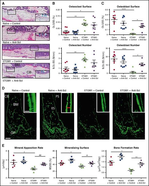 Figure 3. Treatment with anti-sclerostin antibody prevents 5TGM1 myeloma-induced suppression of bone formation. (A) Tartrate-resistant acid phosphatase (TRAP)/hematoxylin-stained histologic sections from representative mice from each treatment group showing osteoblasts on the endocortical bone surface (inset, blue arrows) and osteoclasts reacted for TRAP and stained red (white arrows); scale bar represents 200 µm. Slides were scanned on a Scanscope CS2 (Aperio) up to original magnification ×40, and images were captured by using an Aperio Imagescope at digital magnification ×20. (B) Dot plots of osteoclast surface/bone surface (Oc.S/BS) and number of osteoclasts/bone surface (N.Oc/BS) (data are mean ± 1 SEM; *P < .05; **P < .001). (C) Dot plots of osteoblast surface/bone surface (Ob.S/BS) and number of osteoblasts/bone surface (N.Ob/BS) (n = 8) (data are mean ± 1 SEM; *P < .05; **P < .001). (D) Representative sections from each group showing mineralized bone surfaces labeled with calcein. Images were captured on a Leica DMI 5500 at ×2.5 by using LAS X software (Leica); scale bar represents 500 µm. Double-label bone surfaces were used to measure mineral apposition rate (inset: red arrows show the distance between 2 labels separated by a fixed time interval). Images were captured on a Leica DMI 5500 at ×40 using LAS X software (Leica). Scale bar represents 20 µm. (E) Dot plots of MAR, mineralizing surface (MS), and BFR (n = 5; data are mean ± 1 SEM; *P < .05; **P < .01; #P < .05 (Student t test); ##P < .01 (Student t test). ES, endosteal bone surface; PS, periosteal bone surface.