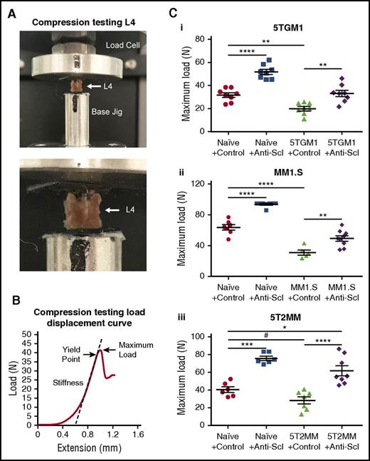 Figure 5. Treatment with anti-sclerostin antibody prevents loss of bone mechanical strength in myeloma-burdened bones. (A) Images demonstrating the positioning of L4 vertebrae for compression testing between the load cell and the custom-designed jig in the Instron 5944 load frame. (B) Representative load displacement curve of an L4 vertebra from the naive control group showing the outcomes of stiffness, yield point, and maximum load at the first point of failure. (C) Dot plots of maximum load for L4 vertebrae from the (i) 5TGM1-eGFP, (ii) MM1.S, and (iii) 5T2MM models of myeloma (5TGM1: n = 8; MM1.S: n = 5-9; 5T2MM: n = 6-8). Data are mean ± 1 SEM; *P < .05; **P < .01; ***P < .001; ****P < .0001; #P < .05 (Student t test).