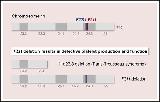 The genes encoding hematopoietic transcription factors ETS1 and FLI1 are located on chromosome 11q24.3, which is deleted in PTS. Using PTS-specific (11q23.3 deletion) and genome-edited (FLI1 deletion) induced pluripotent stem cell–derived iMegs, Vo et al find that the megakaryocyte/platelet defects observed in patients with PTS are due solely to hemizygous deletion of the TF FLI1.
