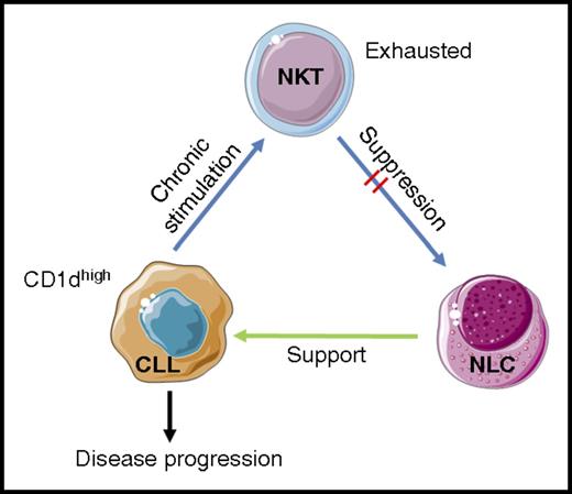 Model for CD1d-dependent CLL disease progression. Gorini and colleagues postulate that chronic stimulation of NKT cells with high levels of CD1d/self-ligand complexes on CD1dhi CLL cells leads to NKT cellular exhaustion. The exhausted NKT cells therefore have a diminished ability to engage and suppress differentiation and function of CD1d+ NLCs. Removal of NLC suppression allows them to support CLL cells, thus increasing the chance of disease progression. Images adapted from Servier Medical Art under a Creative Commons CC-BY license.