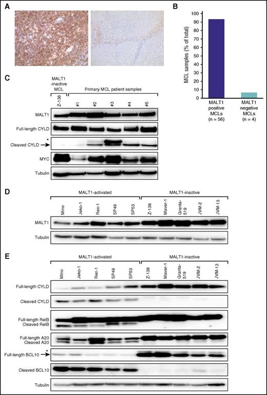 Figure 1. MALT1 expression and activity in MCL. (A) Immunohistochemical MALT1 staining of a MALT1-positive MCL case (left; original magnification ×200) and a MALT1-negative MCL case (right; original magnification ×100). Images were captured using a Leitz DMRB microscope (Leica Microsystems, Wetzlar, Germany) equipped with Fluotar objective lenses (10×/0.30 numeric aperture, 20×/0.50 numeric aperture) and a KY-F75U digital camera (Victor, Yokohama, Japan) and were processed with the Diskus Program 4.20 (Hilgers Technical, Königswinter, Germany) that converts and exports images in .jpg file format. (B) MALT1 expression in MCLs determined by immunohistochemistry. (C) Western blot analysis of MALT1, full-length and cleaved forms of CYLD, and MYC. MALT1 was highly expressed in CD20+ cells isolated from either PBMCs (patient samples 1 and 2) or lymph nodes (patient samples 3-5) of 5 primary MCL patient samples. Cleaved CYLD indicating MALT1 proteolytic activity was detectable in 4 of 5 patient samples. MYC expression was higher in these 4 samples with activated MALT1. The MCL cell line Z-138 was used as a positive control for MALT1 expression and as a negative control for CYLD cleavage. *Nonspecific band, which was not observed in any MALT1-activated MCL cell lines (Figure 1E). (D) Western blot analysis of MALT1 expression in MCL cell lines. MALT1 protein expression was detectable in all MCL cell lines. (E) Western blot analysis of different MALT1 targets. Cleaved forms of CYLD, RelB, A20, and BCL10 were detectable in Mino, Jeko-1, Rec-1, SP49, and SP53 cells. *Nonspecific band.