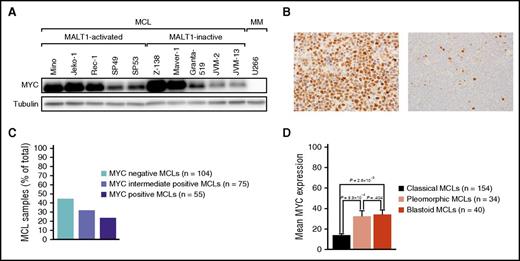 Figure 6. MYC expression in MCL. (A) Western blot analysis of MYC expression in 10 MCL cell lines and in the MM cell line U266. All MCL cell lines had detectable MYC expression compared with the negative control U266. (B) Immunohistochemical MYC staining of an MYC-positive MCL case (left: original magnification ×400) and an MYC-negative MCL case (right: original magnification ×400). Images were captured using an Olympus BX51 microscope (Olympus, Tokyo, Japan) equipped with an Olympus DP73 camera and were processed with Olympus cellSens software. (C) Frequency of MYC expression in MCL. (D) Mean MYC expression in cytological MCL variants. MYC expression was significantly higher in pleomorphic and blastoid variants compared with classical MCLs. Error bars indicate the standard error of the mean.